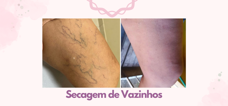 Antes e depois da secagem de vasinhos